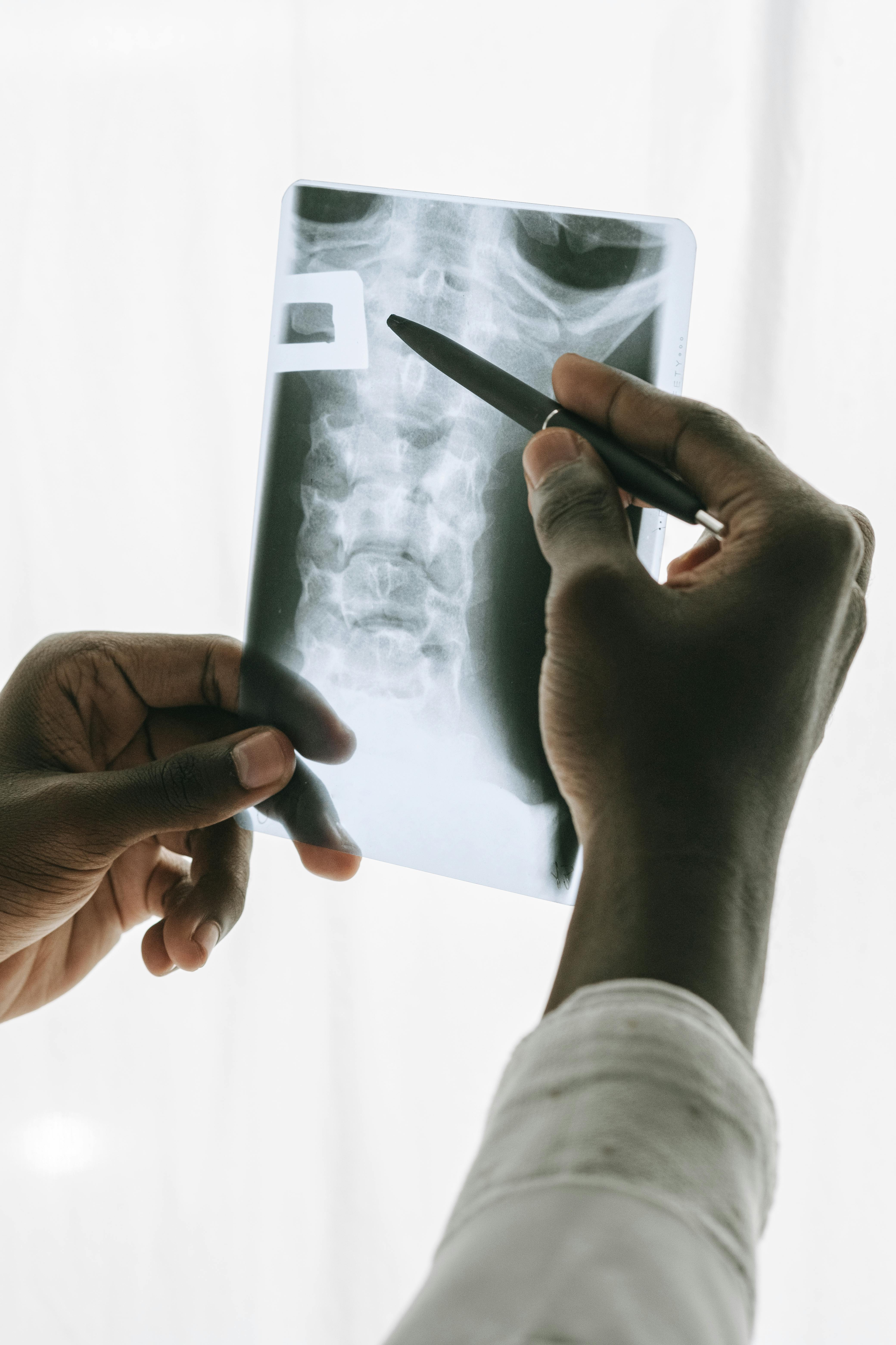 X-Ray